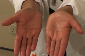Effective Hand Hygiene